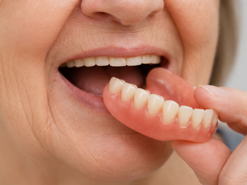 Dentures (Complete & Partial)