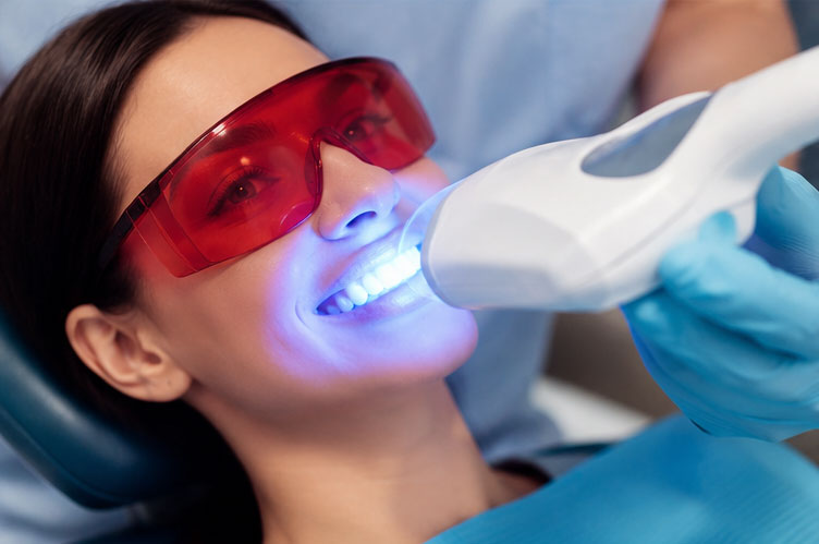 Laser Teeth Whitening